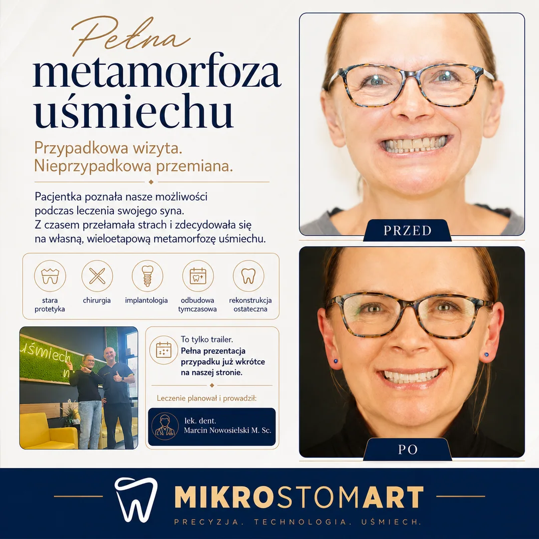 A complete smile transformation — an accidental visit, a deliberate change
